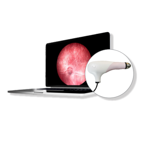 Sistema de Imagen de Fondo SK-8000A/B/C